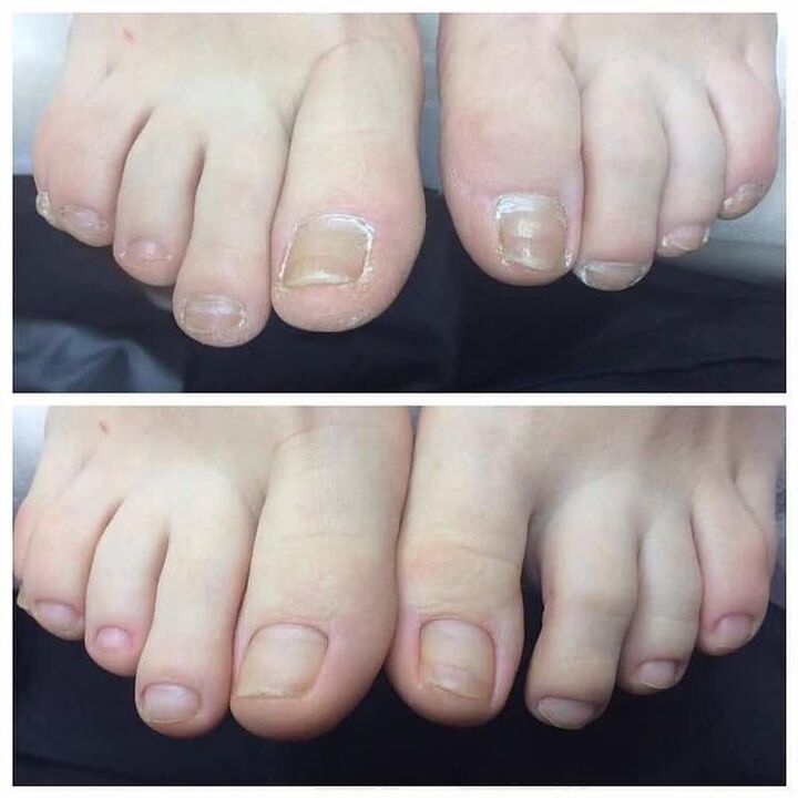 avis d'utilisation Exodermin