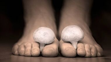 Comment reconnaître la présence de champignons sur les jambes