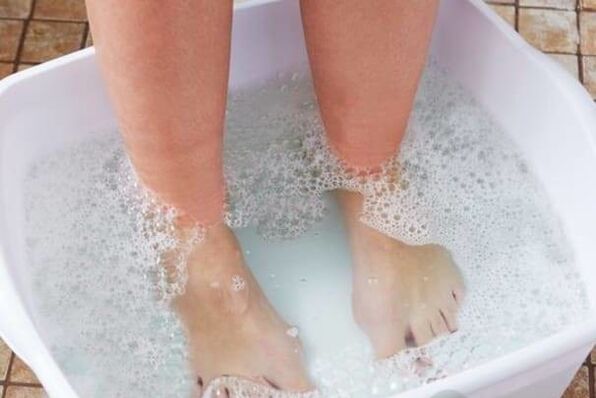 Traitement des champignons à ongles avec remèdes populaires