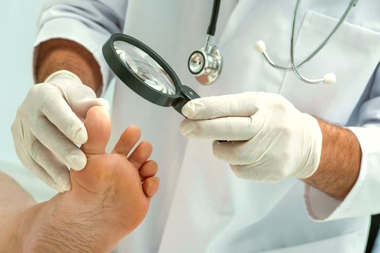 dermatologue examinant les ongles des pieds