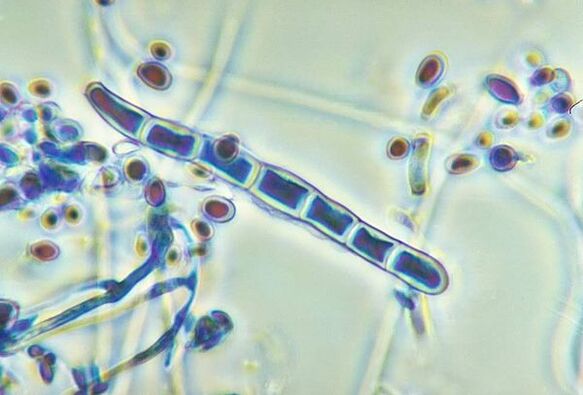 Champignon Trichophyton rubrum sous un microscope