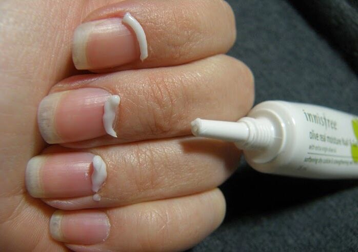 traitement de la mycose des ongles avec une pommade