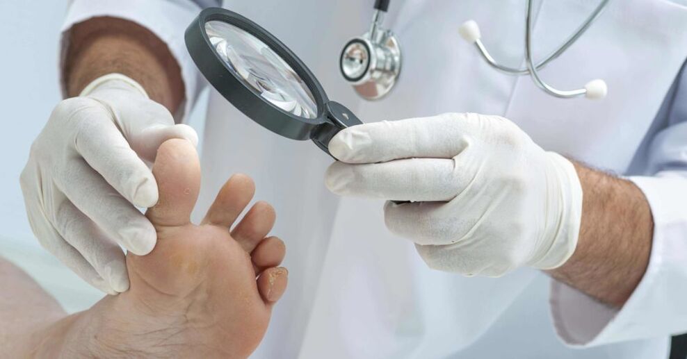 le médecin examine les pieds à la recherche de champignons