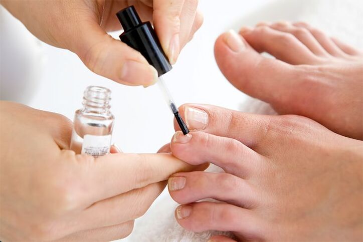 vernis contre les mycoses des ongles